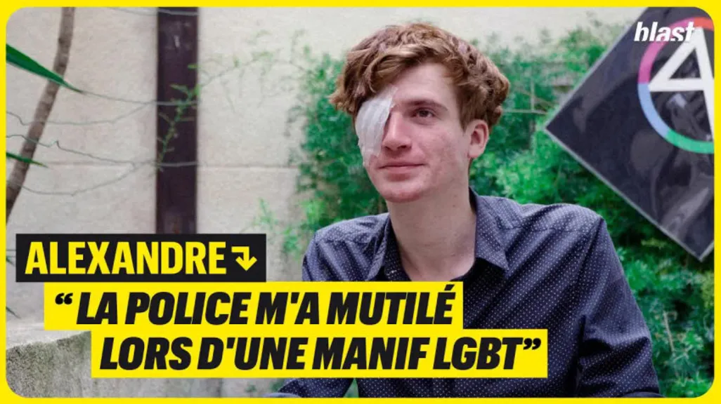 Alexandre : "La police m'a mutilé lors d'une manif LGBT"