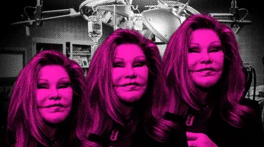 Chirurgie réparatrice : Aimé, la riche veuve qui voulait ressembler à une lionne