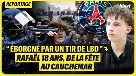 "Éborgné par un tir de LBD" : Rafaël 18 ans, de la fête au cauchemar
